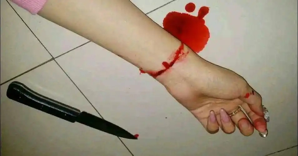 手腕自残流血真实视频