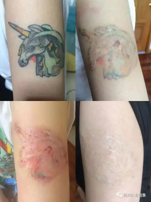 洗纹身必看很重要的注意事项