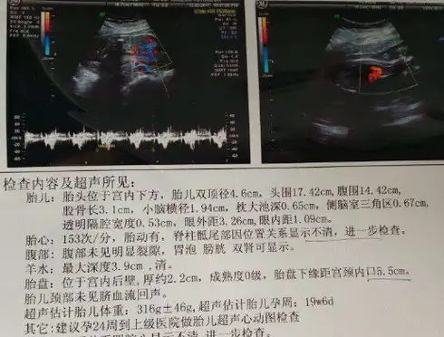 b超单上这3个"数据",和胎儿的出生时间的有关,早知道早受益_时候_数值