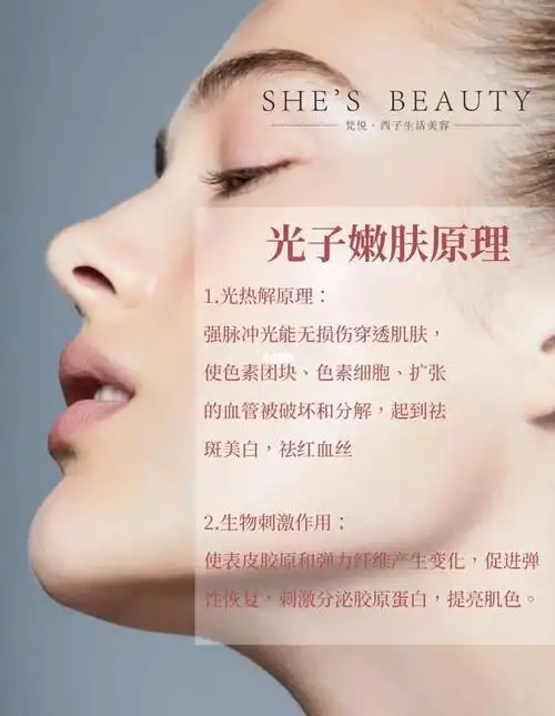 光子嫩肤原理71_光子嫩肤_皮肤管理_海报_美业_美白_胶原蛋白_shes