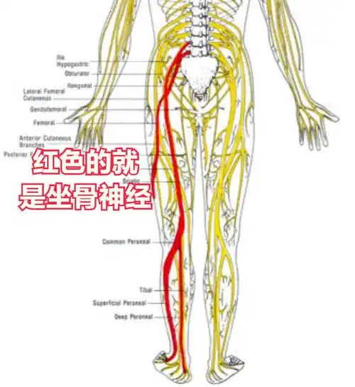 腰椎穿出的神经,很大一部分汇集成坐骨神经 ,所以腰椎间盘突出压迫到