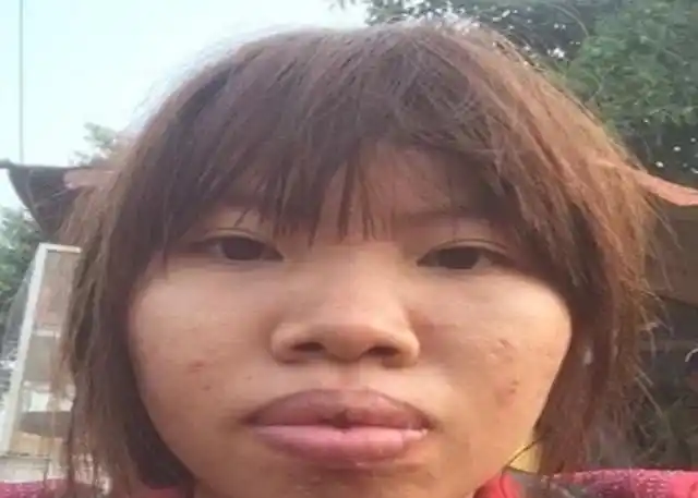 越南第一丑女花十万整容变美后嫁入豪门,孩子生下来富豪怒了