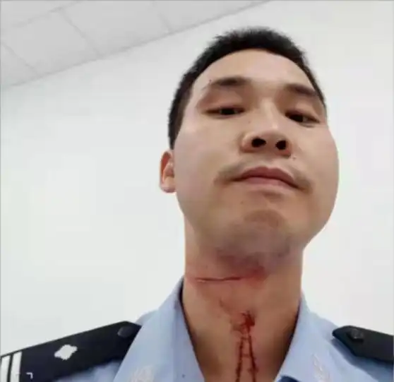 民警狂追逃犯 抓到后才发现脖子血流不止