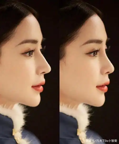 别再追求千篇一律的网红小翘鼻了,淡淡驼峰鼻才是美女脸的标配