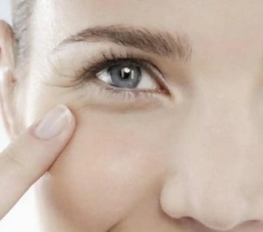 互动问答| 脸上有细纹怎么办?