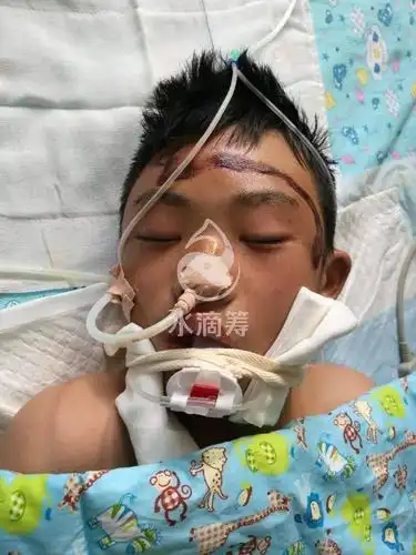 枣庄13岁少年遭车祸在icu命悬一线请救救他