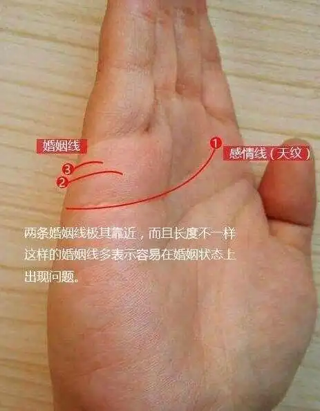 2,两条婚姻线,金星带重叠断掌纹就是手上的婚姻线和智慧线重叠成一条