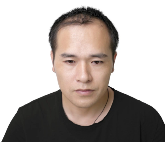 别叫我秃头男信不信我分分钟帅到你