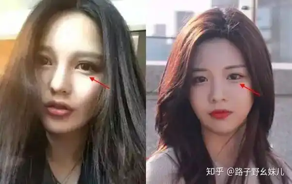 被霸凌造就的韩国最新整容模板高允真初恋颜堪比全智贤