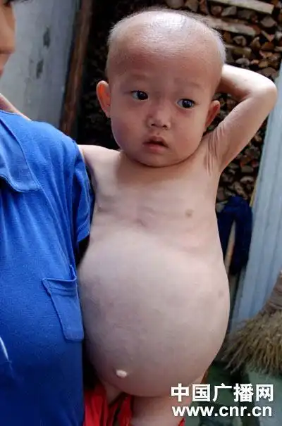 黄泽俊肚子腰围大得有60多厘米