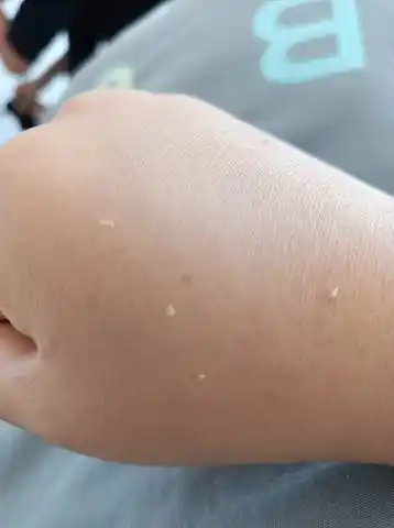 育儿问答 怀孕期 乳头上分泌这种东西,是啥?