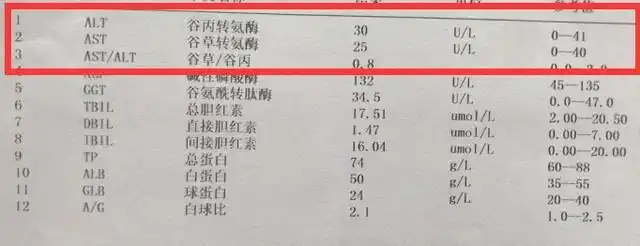 喝酒一定会得酒精肝吗?都需要做哪些检查呢?