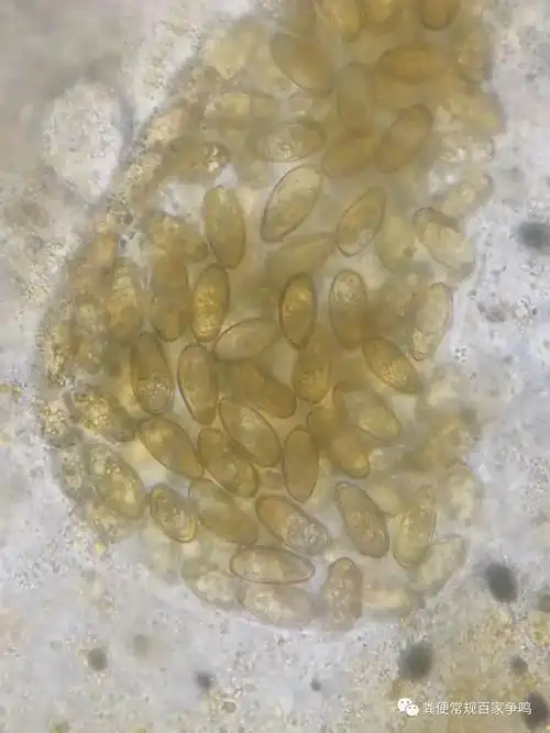 肝吸虫卵如此高清照片赶快收藏