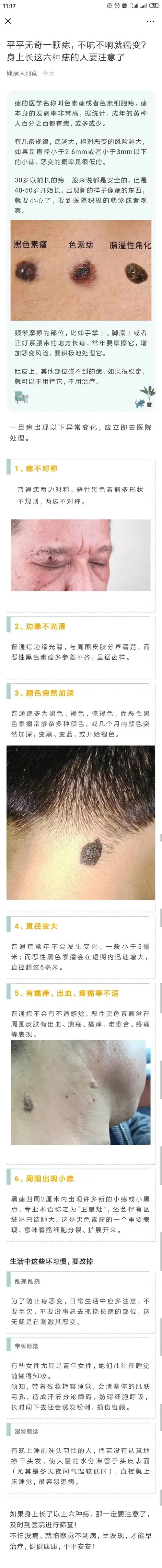 平平无奇一颗痣,不吭不响就癌变?