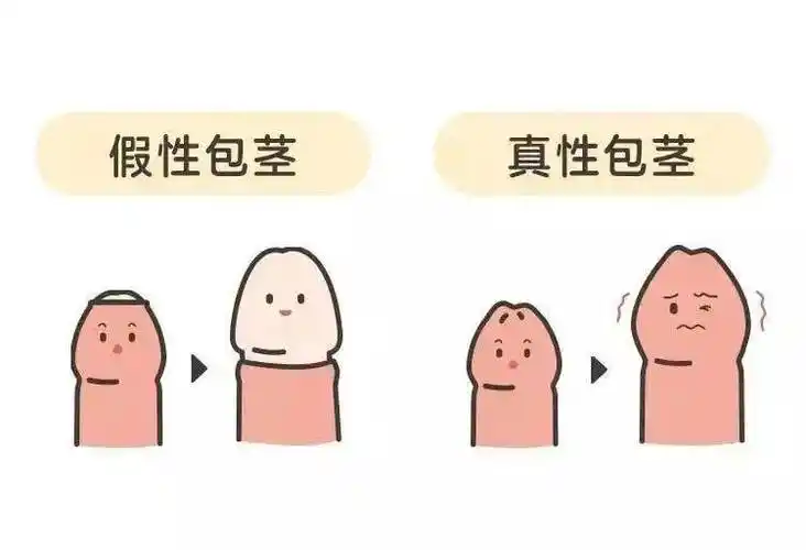 正常的小鸡鸡会把包皮是个绕不过去的问题要不要「割包皮」在养育男孩