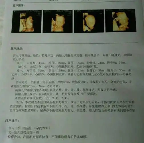 四维确认女宝b超图四维彩超的时候医生说小孩手长脚长是男孩还是女孩