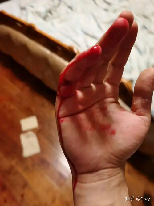 平静的疼 - 知乎