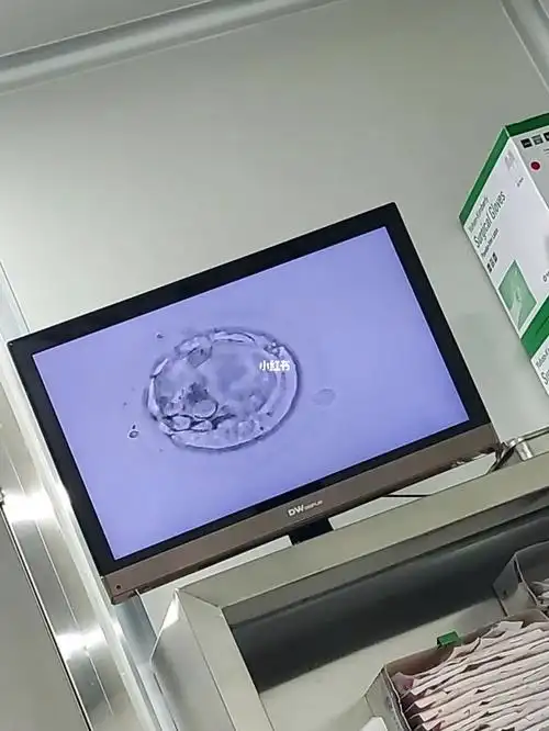 中下移植只花了10分钟不到 躺了1个多小时回去后 好好休息了 第二天也