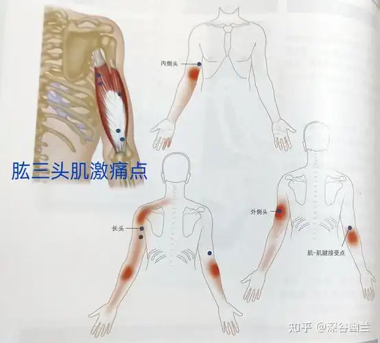 手肘前臂内侧疼痛的居家调养
