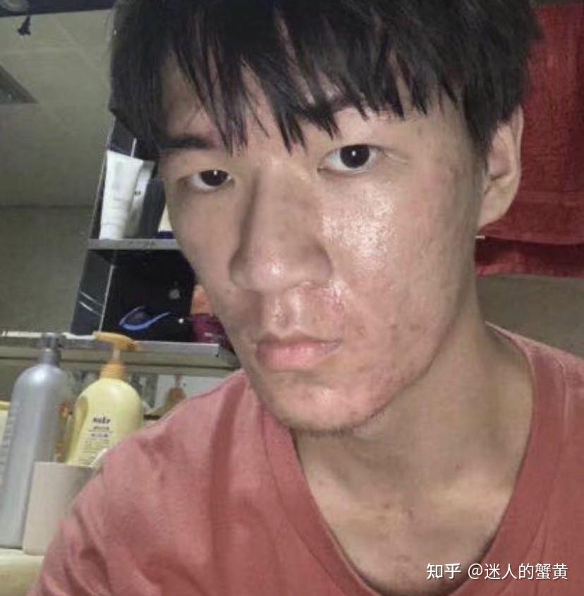 网恋对象这样算丑吗要分手吗