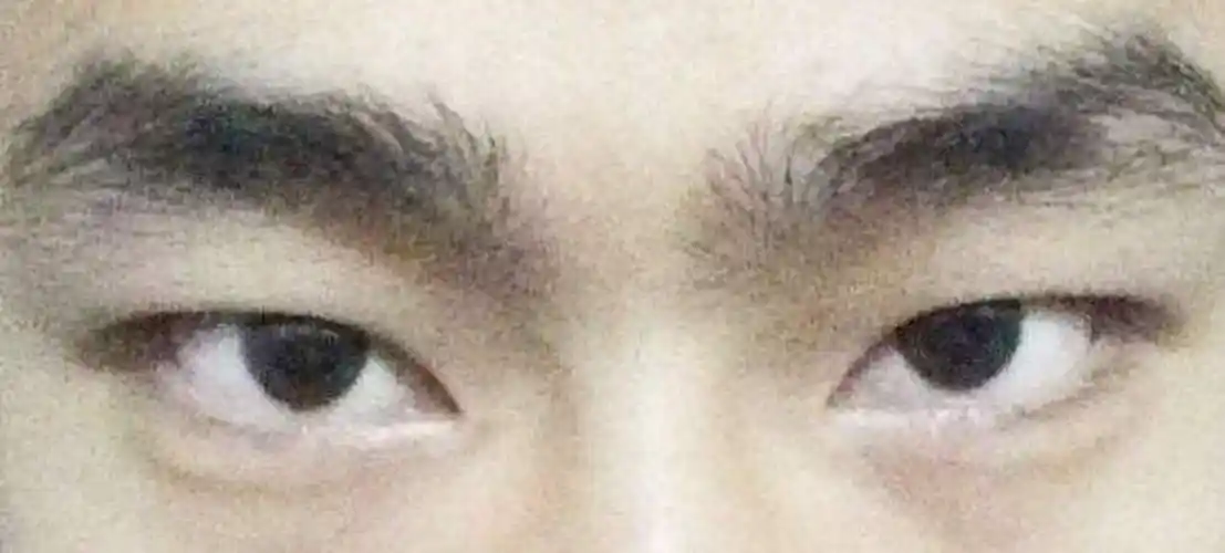 眼珠突出的人面相(眼球突出的女人性格)