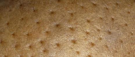 同心医关注乳腺健康远离乳腺癌