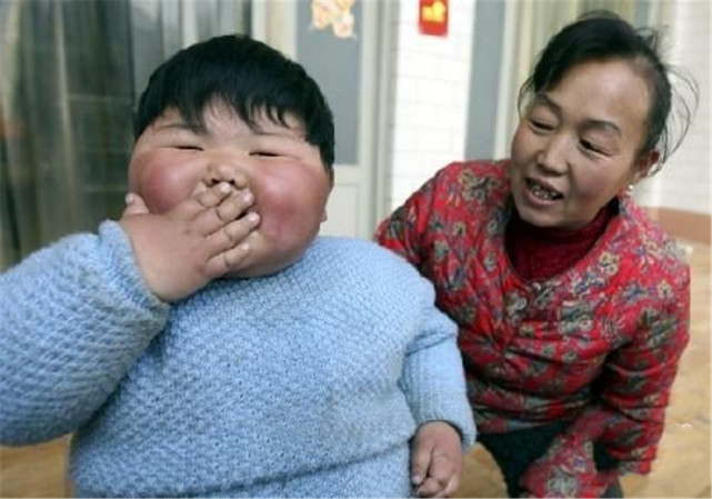 孙子胖成"米其林宝宝",奶奶逢人就夸自己养得好,医生:太无知
