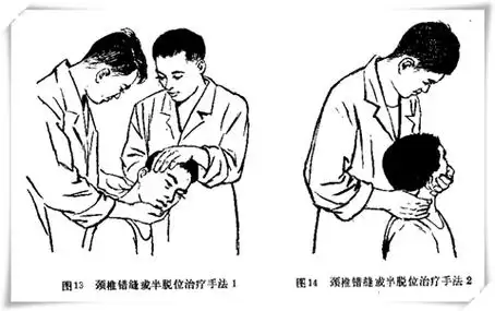 腰椎间盘突出复位手法