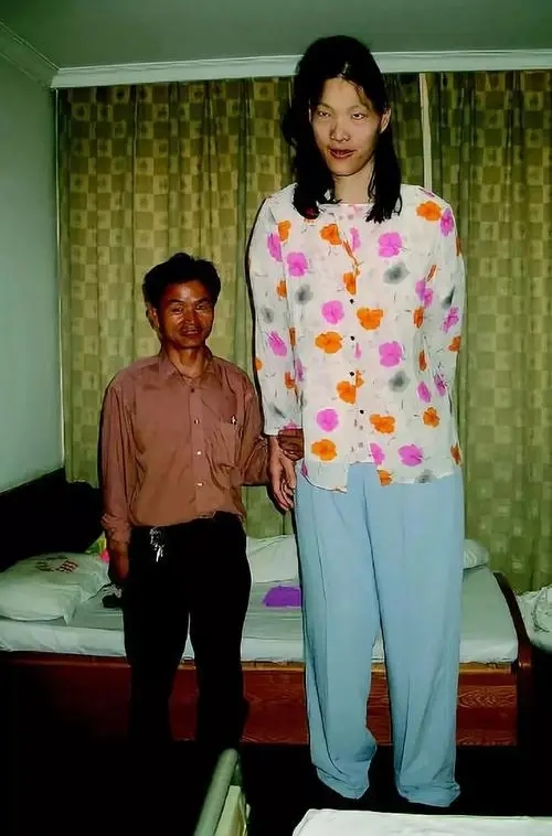 安徽女巨人:23岁身高2米4,比姚明还高,要穿78码的定制鞋子