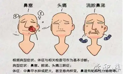 鼻炎的症状都有哪些表现(鼻炎症状的介绍) - 新星集网
