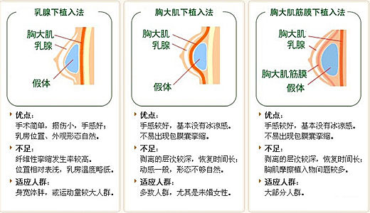 无胸器 不cj:揭秘傲人胸器是怎样速成的