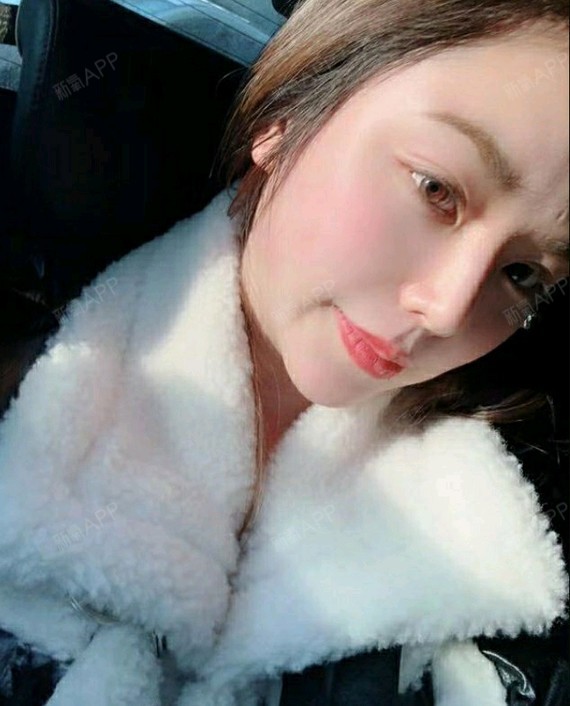 做了个自然款的鼻子,真的太美了～很符合我的五官和审美,果真