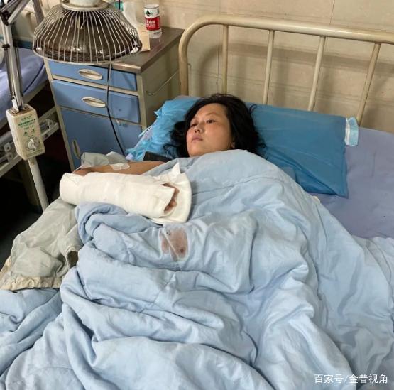 杨世琴双臂,双腿缠满了绷带,全身多处受伤,躺在宜宾南溪区中医院的