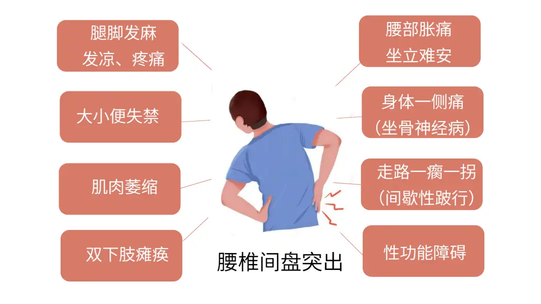 到底是腰肌劳损,还是腰椎间盘突出?_腰部_病人_进行