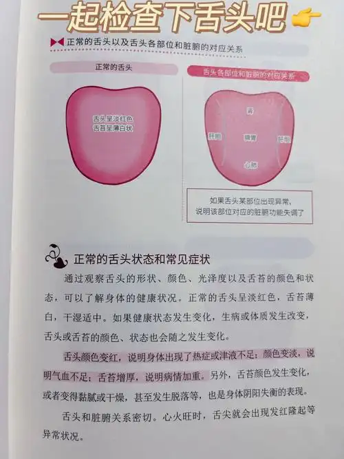 观舌头识健康宝子们一起来自查吧