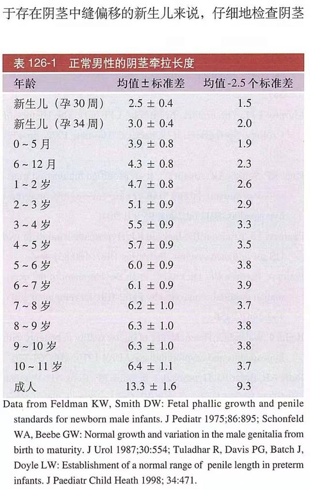 男孩小弟弟长度多长算正常