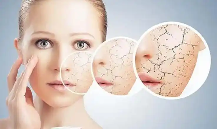 皮肤缺水怎么办?这6个补水技巧教你改变!